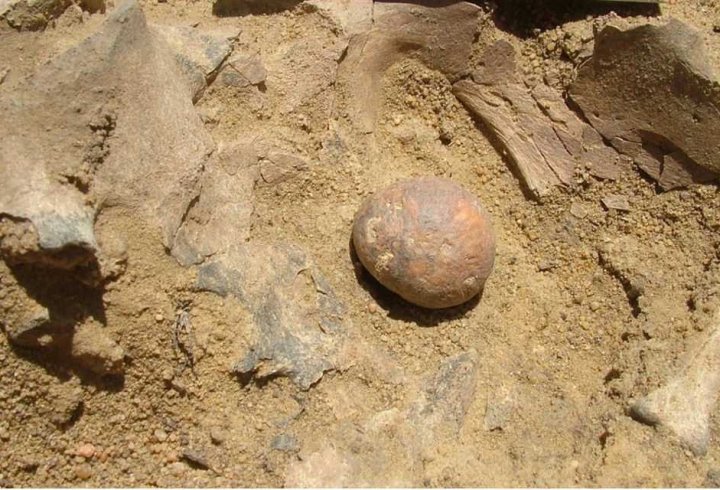 Найдавніші камені в простаті виявили у чоловіка кам'яного віку (фото)