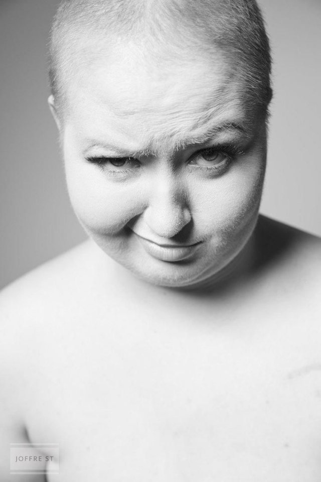 Відверта фотосесія дівчини, котра пережила рак грудей (фото)