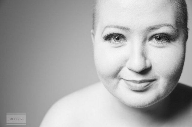 Відверта фотосесія дівчини, котра пережила рак грудей (фото)