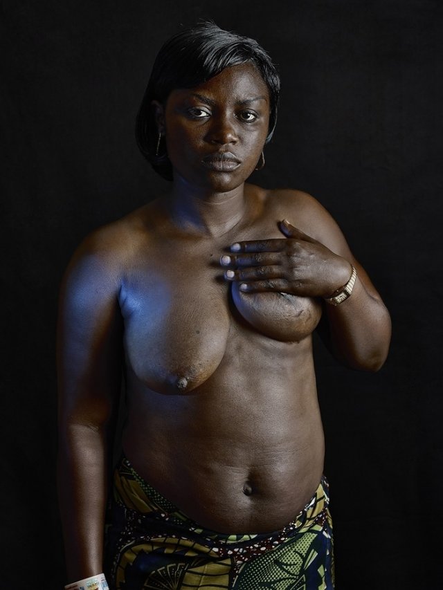 Прасування грудей - шокуюча традиція Камеруну (фото)