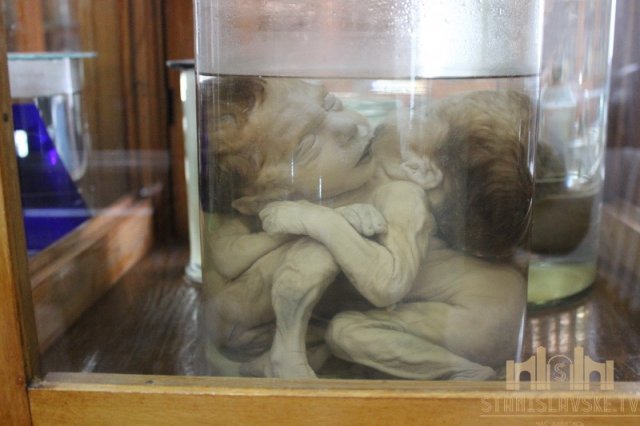 У Франківську відкрили Анатомічний музей - муміфіковані тіла, скелети та органи (фото)