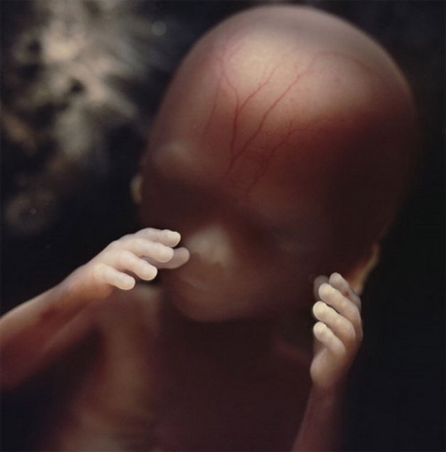 Від зачаття до пологів: 9 місяців розвитку немовляти в 19 фотографіях