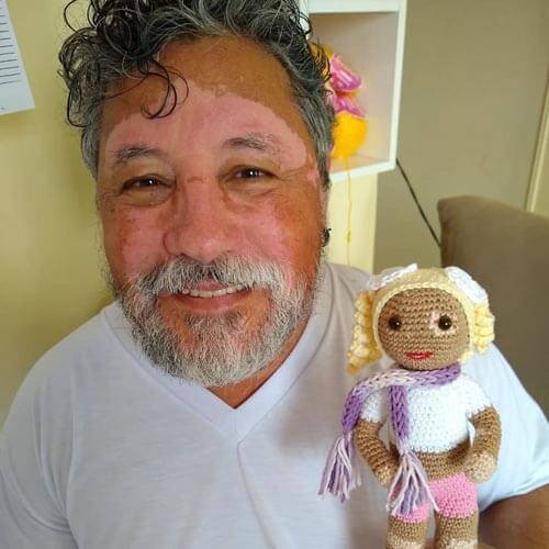 Дідусь в'яже ляльки з плямами, щоб підтримати дітей з вітіліго (фото)