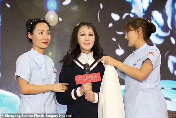 Китайська дівчинка через рідкісну хворобу в 15 років виглядала як бабця, але пластична операція все виправила