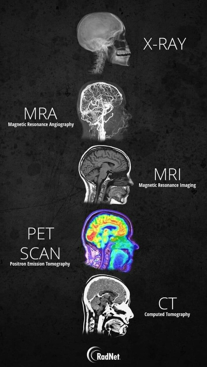 Чим відрізняються рентген, МРТ, КТ та інші види досліджень?