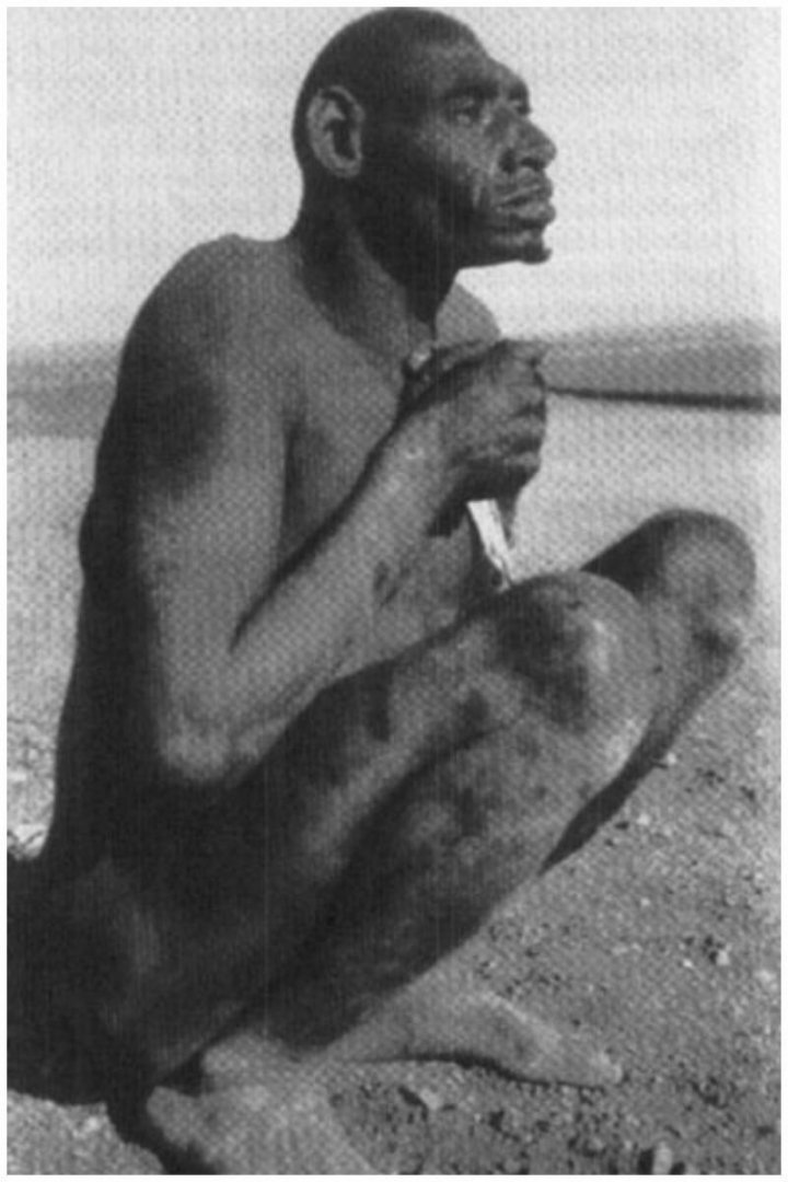 Загадка Аззо Бассоу, якого називали останнім неандертальцем планети (фото)